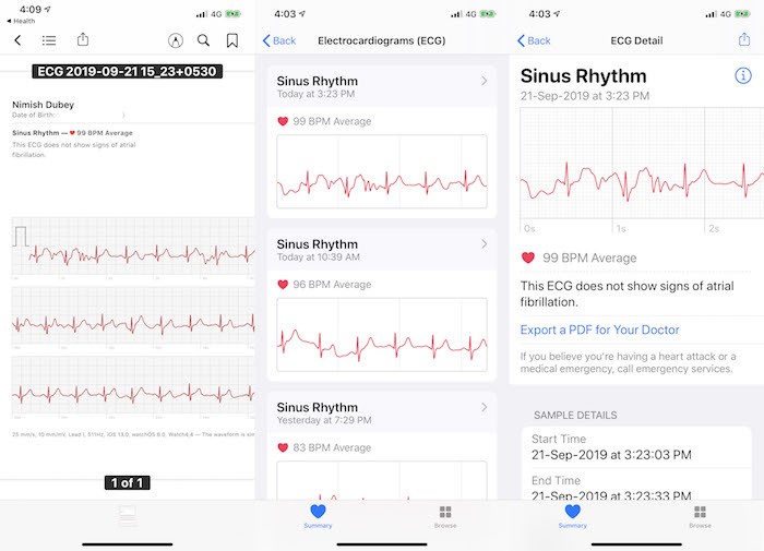 애플 워치, 인도에서 ECG 기능 제공…잘 작동합니다! - 애플 워치 ECG