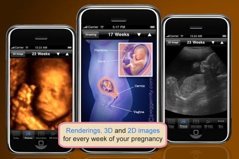 ipregnancy